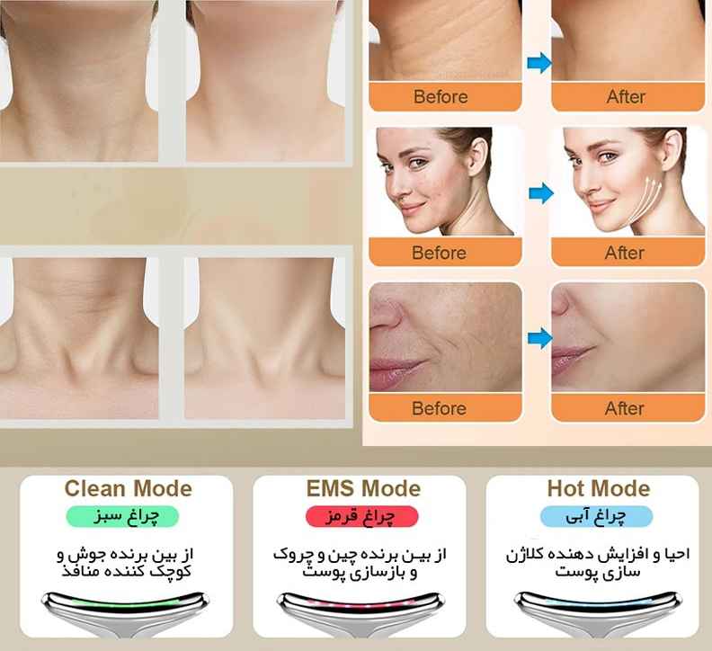 ماساژور صورت و گردن و غبغب  ES1081