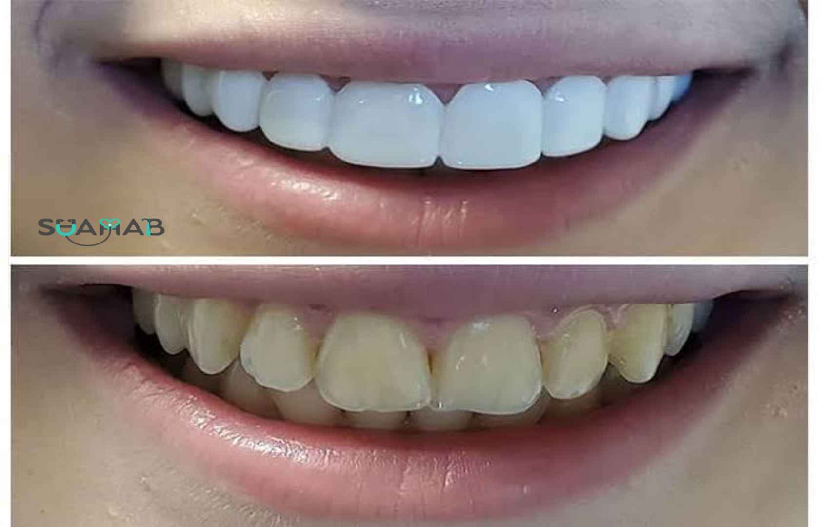 اسنپ آن اسمایل